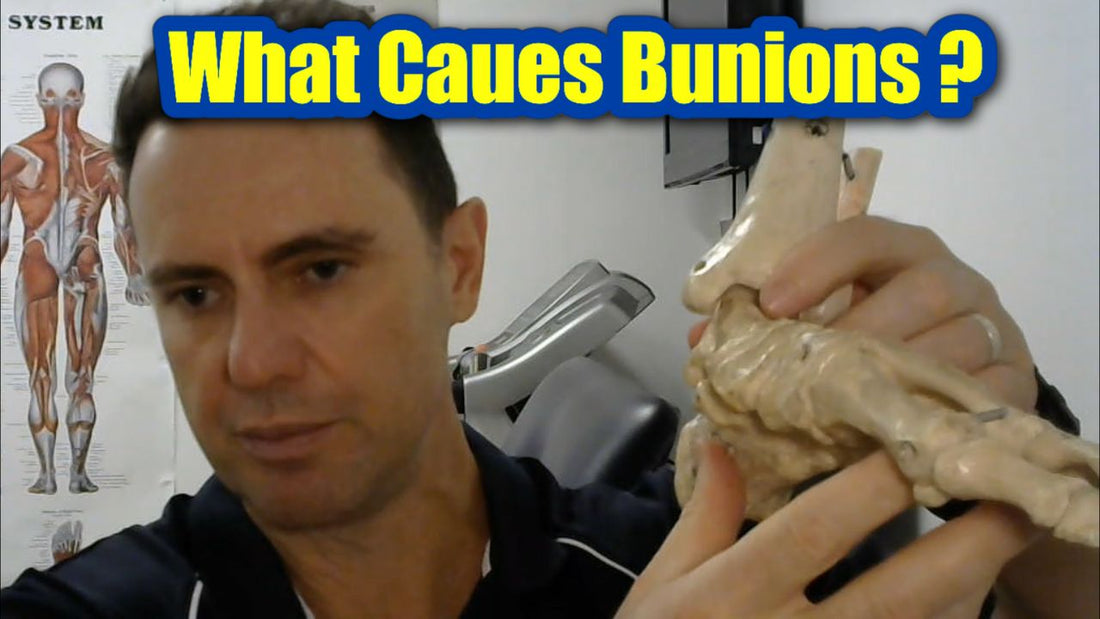 Bunions: What Causes Bunions and Treatment