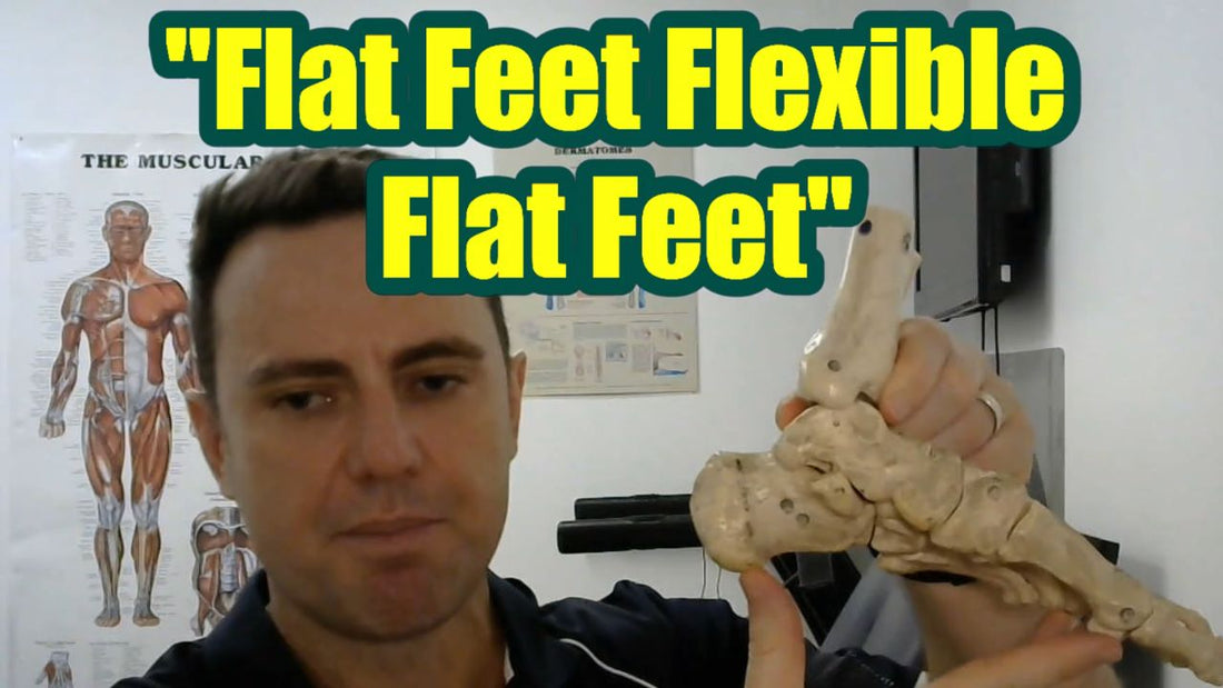 What is Flat Foot and How Do You Fix Flat Foot?